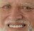 :harold: